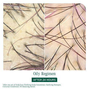 Scalp Sync Purifying Scalp Concentrate - Biolage Renovation NZ | L'Oréal Partner Shop